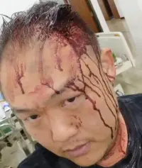 Tak Terima Ditegur, Eks Bendahara Ormas Pukul Kepala Tetangga Pakai Botol Bir Hingga Luka Parah
