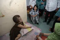 Sukma Adhani Penderita Hydrocephalus Sejak Lahir Berusia 25 Tahun